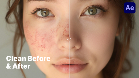 Photo of Minimalistic & Clean Before & After Comparison – Premiere Pro Template – Videohive 60207350