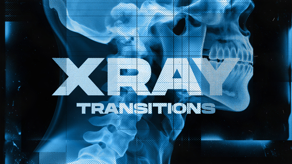 Photo of X-Ray Human Transitions | Premiere Pro – Videohive 61752885